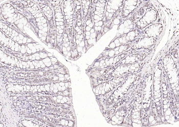KLF12 Rabbit Polyclonal Antibody