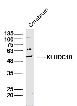 KLHDC10 Rabbit Polyclonal Antibody