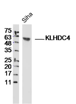 KLHDC4 Rabbit Polyclonal Antibody