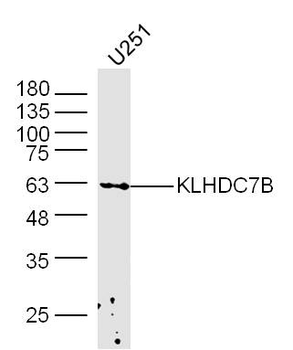 KLHDC7B Rabbit Polyclonal Antibody
