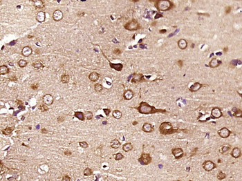 KLHL18 Rabbit Polyclonal Antibody
