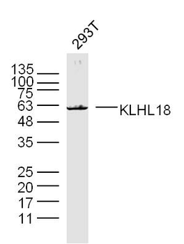 KLHL18 Rabbit Polyclonal Antibody
