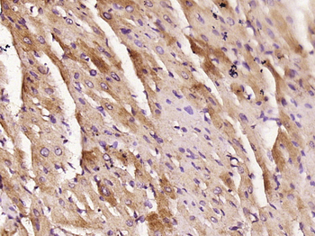 KLHL38 Rabbit Polyclonal Antibody