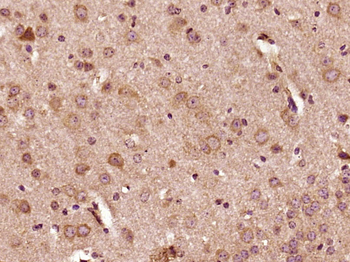 KLHL6 Rabbit Polyclonal Antibody