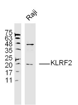 KLRF2 Rabbit Polyclonal Antibody