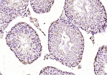 KMT2C Rabbit Polyclonal Antibody