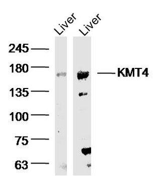 KMT4 Rabbit Polyclonal Antibody