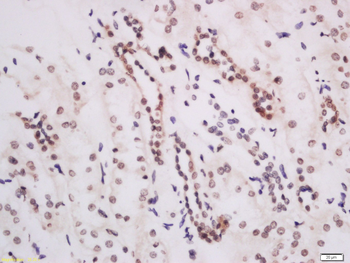 KMT4 Rabbit Polyclonal Antibody