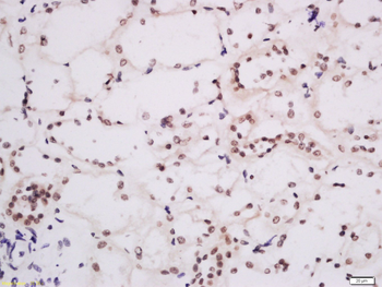 KMT4 Rabbit Polyclonal Antibody