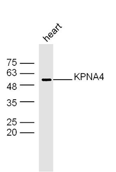 KPNA4 Rabbit Polyclonal Antibody