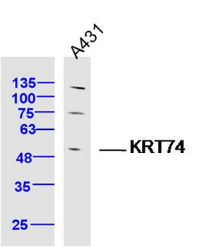 KRT74 Rabbit Polyclonal Antibody