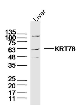 KRT78 Rabbit Polyclonal Antibody