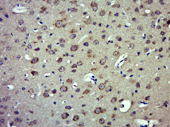 KMO Rabbit Polyclonal Antibody