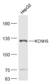 KCNH5 Rabbit Polyclonal Antibody