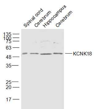 KCNK18 Rabbit Polyclonal Antibody