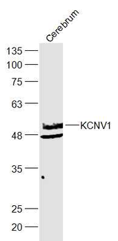 KCNV1 Rabbit Polyclonal Antibody