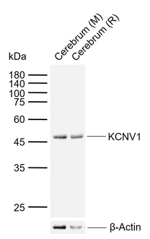 KCNV1 Rabbit Polyclonal Antibody