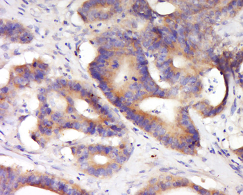KCNV2 Rabbit Polyclonal Antibody