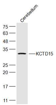 KCTD15 Rabbit Polyclonal Antibody