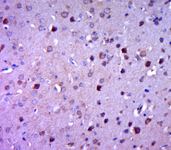 KCTD17 Rabbit Polyclonal Antibody