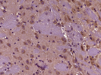 KCTD17 Rabbit Polyclonal Antibody
