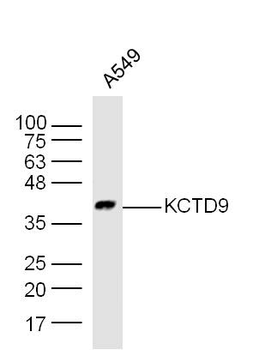 KCTD9 Rabbit Polyclonal Antibody