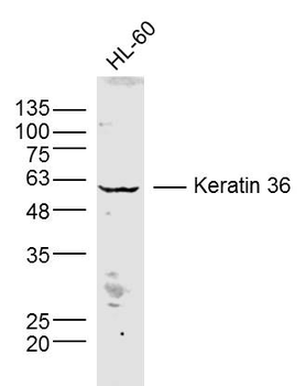 Keratin 36 Rabbit Polyclonal Antibody