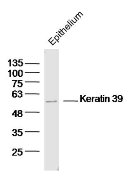 Keratin 39 Rabbit Polyclonal Antibody