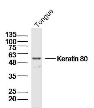 Keratin 80 Rabbit Polyclonal Antibody