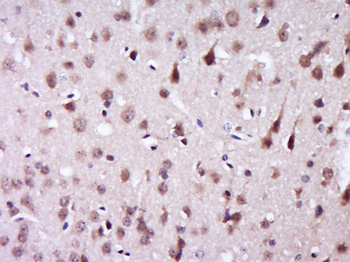KIAA0494 Rabbit Polyclonal Antibody