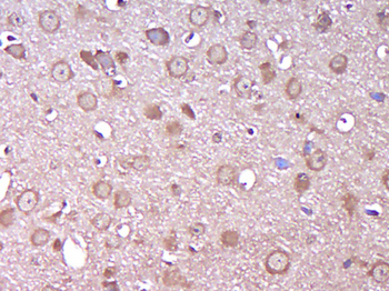 KIAA0513 Rabbit Polyclonal Antibody