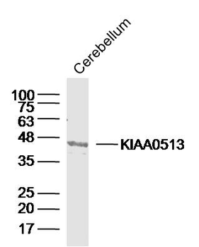 KIAA0513 Rabbit Polyclonal Antibody