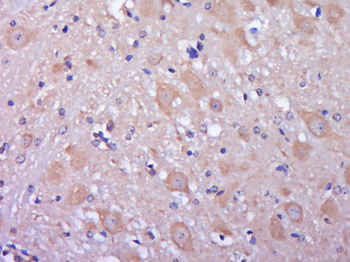 KIAA0556 Rabbit Polyclonal Antibody