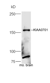 KIAA0701 Rabbit Polyclonal Antibody