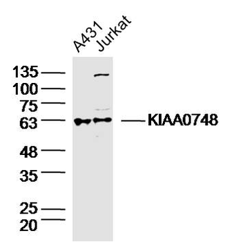 KIAA0748 Rabbit Polyclonal Antibody