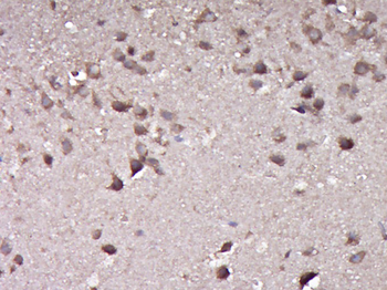 KIAA0859 Rabbit Polyclonal Antibody