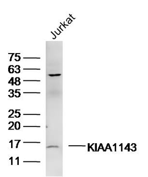 KIAA1143 Rabbit Polyclonal Antibody
