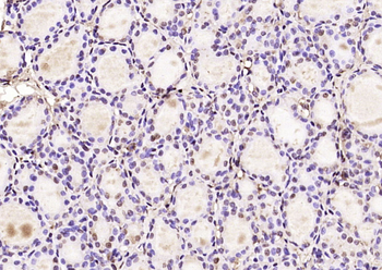 KIAA1456 Rabbit Polyclonal Antibody