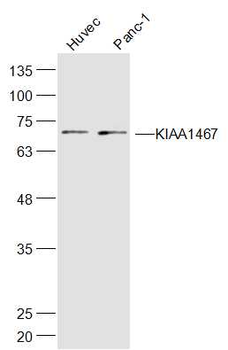 KIAA1467 Rabbit Polyclonal Antibody