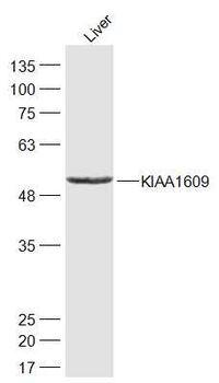 KIAA1609 Rabbit Polyclonal Antibody