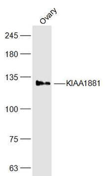 KIAA1881 Rabbit Polyclonal Antibody