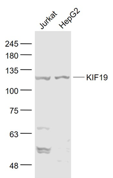 KIF19 Rabbit Polyclonal Antibody