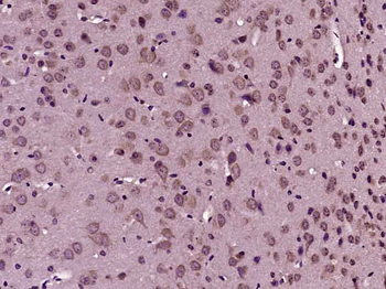 KIF21A Rabbit Polyclonal Antibody