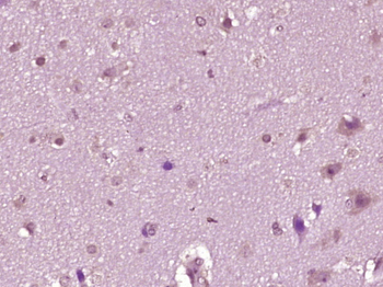 Phospho-KIF22 (Ser427) Rabbit Polyclonal Antibody