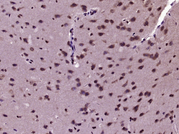 KIF6 Rabbit Polyclonal Antibody