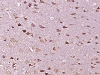 KIFAP3 Rabbit Polyclonal Antibody