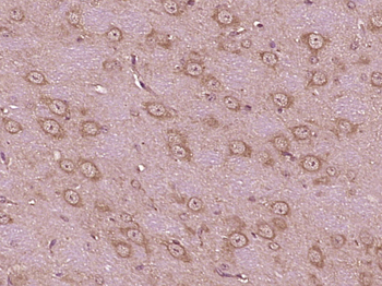 KIF5C Rabbit Polyclonal Antibody
