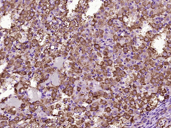 Kinectin 1 Rabbit Polyclonal Antibody