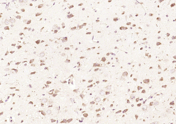Karyopherin beta 3 Rabbit Polyclonal Antibody