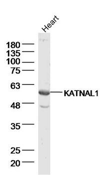 KATNAL1 Rabbit Polyclonal Antibody
